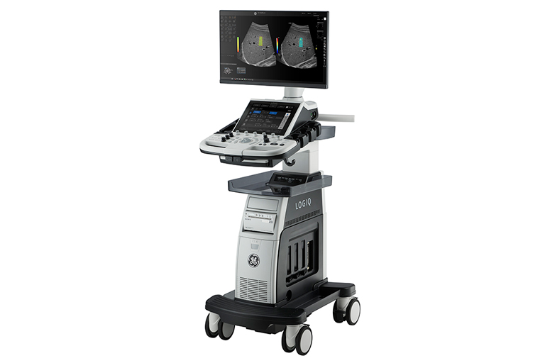 超音波診断装置(エコー)